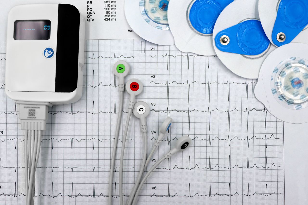 Close-up of ECG device with leads and electrodes on printed heart rate graph, showcasing medical technology.